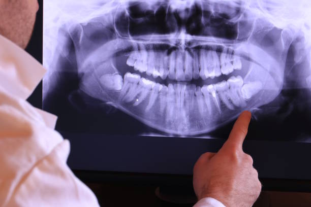 Best Knocked-Out Tooth Emergency  in Argyle, TX